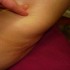 Cellulite on Leg A leg with cellulite
