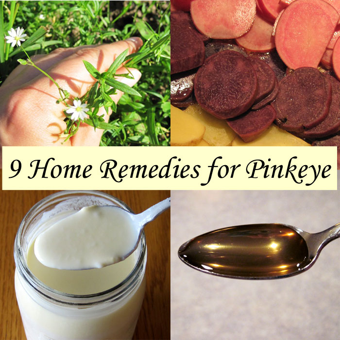 9 home remedies for pinkeye